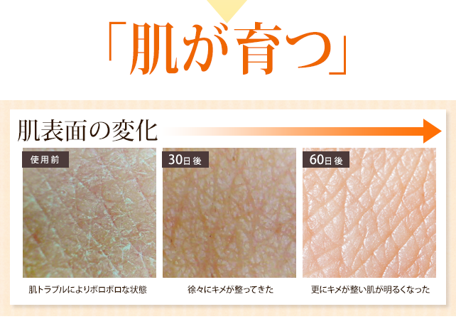 肌が育つ